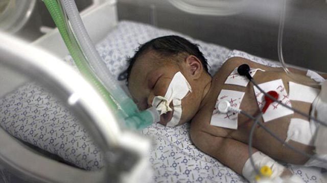 Mucize bebek hayata tutunmayı başardı Mucize bebek hayata tutunmayı başardı