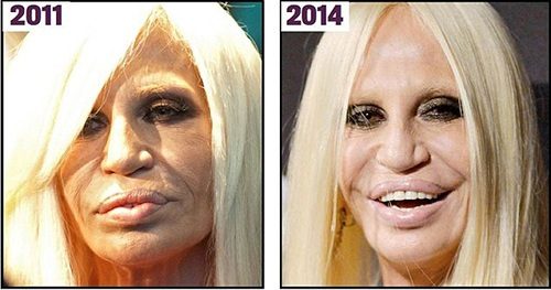 Son olarak havaalanında görüntülenen Versace'yi görenler tanımakta güçlük çekti.