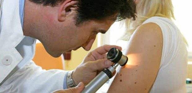 "Düzenli aralıklarla vücuttaki ben değişiklikleri kontrol edilip, bu saydığımız değişikliklerden de şüphe duyuluyorsa mutlaka bir dermatoloğa başvurulmalıdır. Sağlıklı insanlarımıza düşen görev, kendi kendilerine kanser tanısı koymak değil, benleriyle ilgili şüpheli durumun aydınlığa kavuşturulması için dermatoloğa başvurmaktır. Çünkü yukarıdaki değişikliklerin gerçekten var olduğu durumlarda bile tam bir tanı için hekim muayenesi şarttır."
