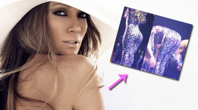 Jennifer Lopez’in konserde pantolonu yırtıldı