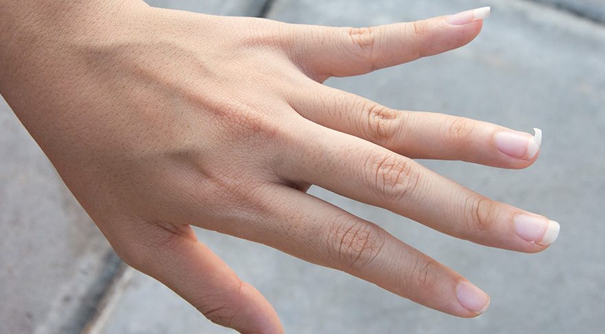 Tırnaklarınız sık sık kırılıyorsa hormon seviyelerinizi kontrol ettirmeniz önerilmektedir.