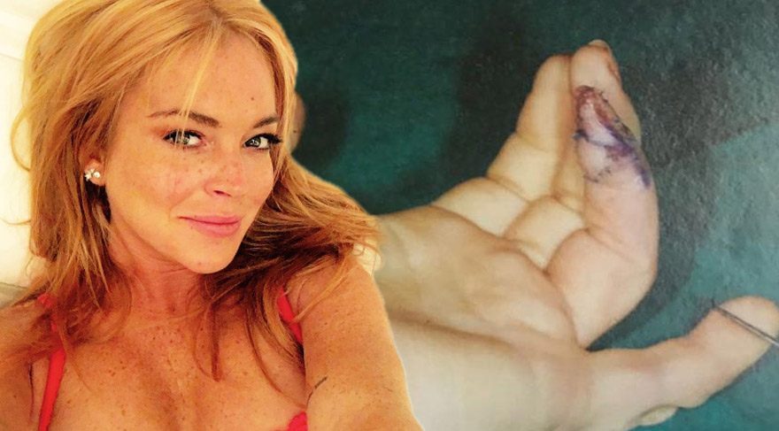 Lindsay Lohan’ın geçirdiği operasyondan görüntüler