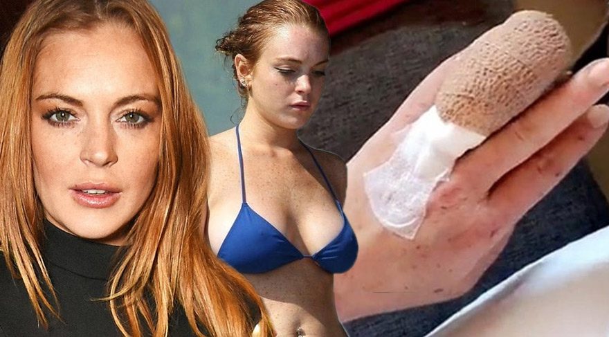 Lindsay Lohan’ın parmağının yarısı koptu