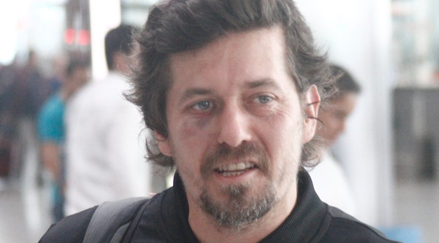 Mete Horozoğlu morarmış gözüyle ilgili açıklamada bulundu