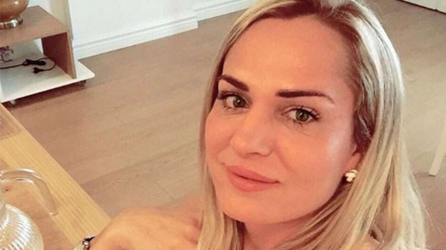 Survivor Nagihan Karadere botoks mu yaptırdı? O iddialara yanıt verdi