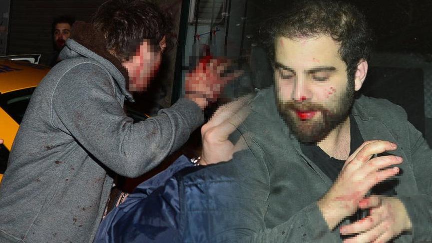 Oğuz Çetin’in oğlu kavgaya karıştı! Hastanelik oldu