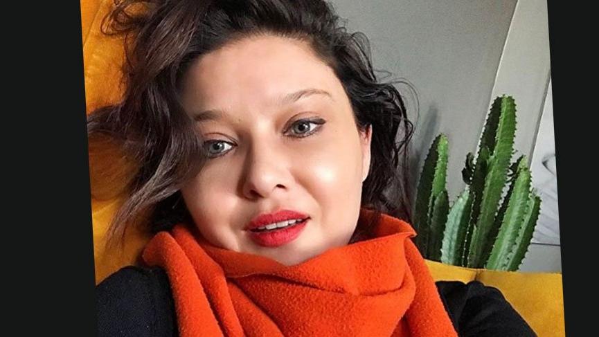 Nurgül Yeşilçay botoks üzerinden hayata dair mesaj verdi