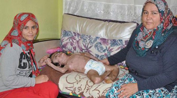 Hidrosefali Hastasina Evde Bakim Soku Sozcu Gazetesi