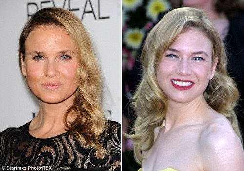 Hatta geçtiğimiz yılın son günlerinde yüzünde benzer bir değişimle kameralar karşısına çıkar Renee Zellweger'a benzeterek "Galiba aynı doktor onları bu hale getirdi" yorumunu yapanlar dahi oldu.