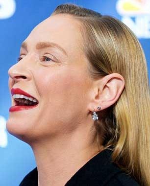 Hatta geçtiğimiz yılın son günlerinde yüzünde benzer bir değişimle kameralar karşısına çıkar Renee Zellweger'a benzeterek "Galiba aynı doktor onları bu hale getirdi" yorumunu yapanlar dahi oldu.