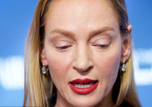 Estetik uzmanları da Thurman'ın tamamen farklı göründüğü düşüncesinde.