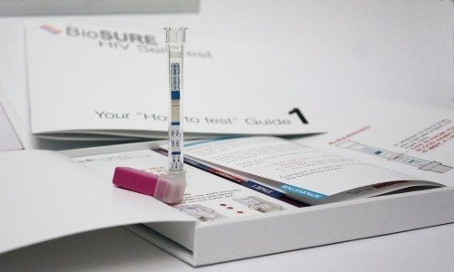 Evde yapılabilen ilk AIDS testi Sözcü Gazetesi