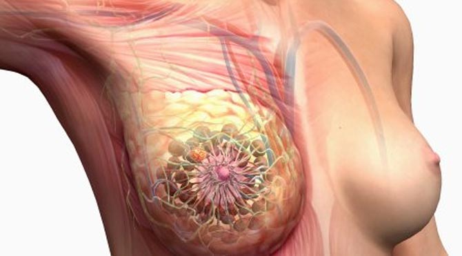 Rahim Agzi Kanseri Genetik Midir Youtube