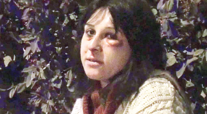 Çığlık attı kurtuldu