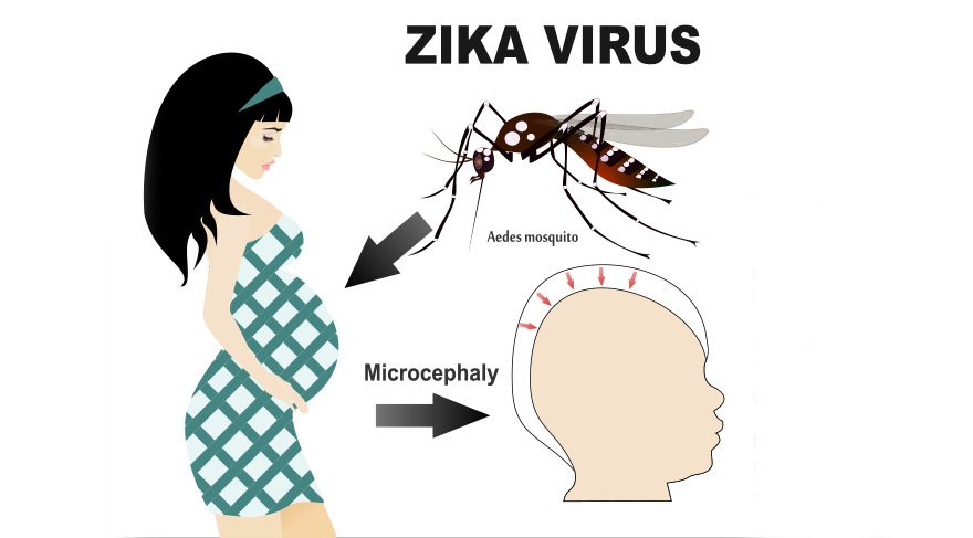 Zika virüsü nedir?