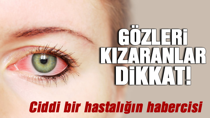 Örgü Kenarlarına Süsleme Çeşitleri Yapılışı Anlatımlı Türkçe Videolu Örgü Kenarlarına Süsleme Çeşitleri Yapılışı Anlatımlı Türkçe Videolu