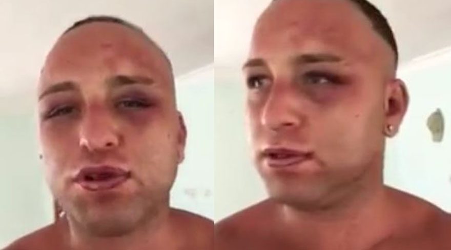Survivor Taner 15 kişiden dayak yedi!