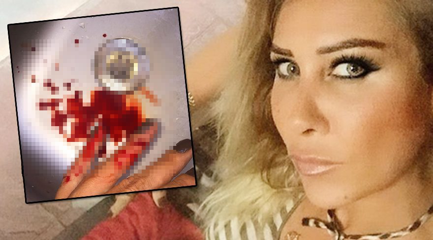 Gizem Özdilli’den kanlı paylaşım