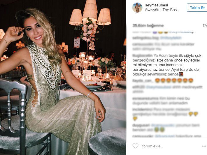 şeyma subaşı estetiksiz hali
