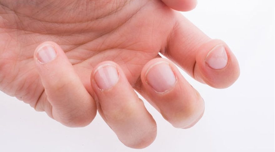 tirnak diplerindeki beyazlara dikkat