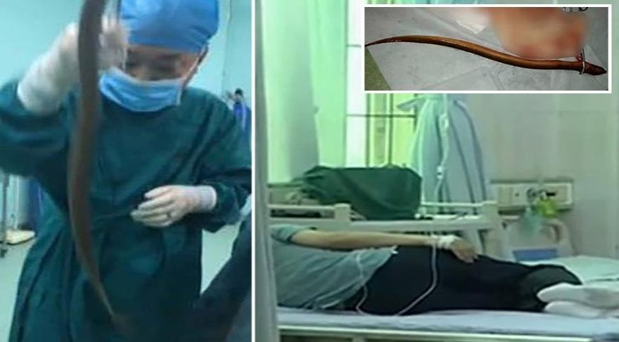 Kabızlıktan kurtulmak için uyguladığı yöntem canından ediyordu!