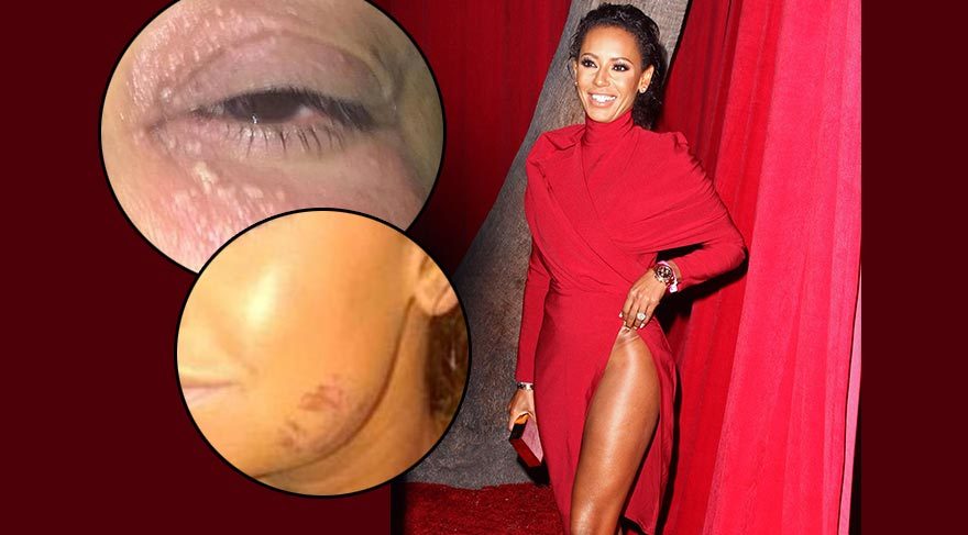 Mel B’nin boşanma davasından sızan şiddet iddiaları