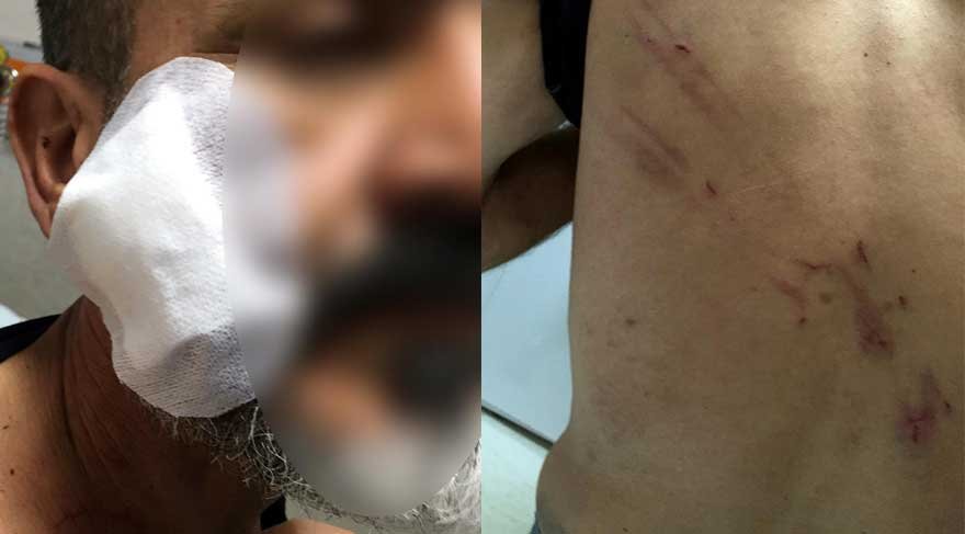 İşadamına karakolda işkenceden 4 polise dava açıldı