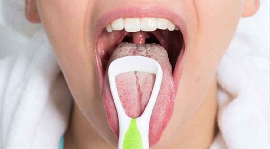 dildeki beyaz yaralarin nedenleri ve