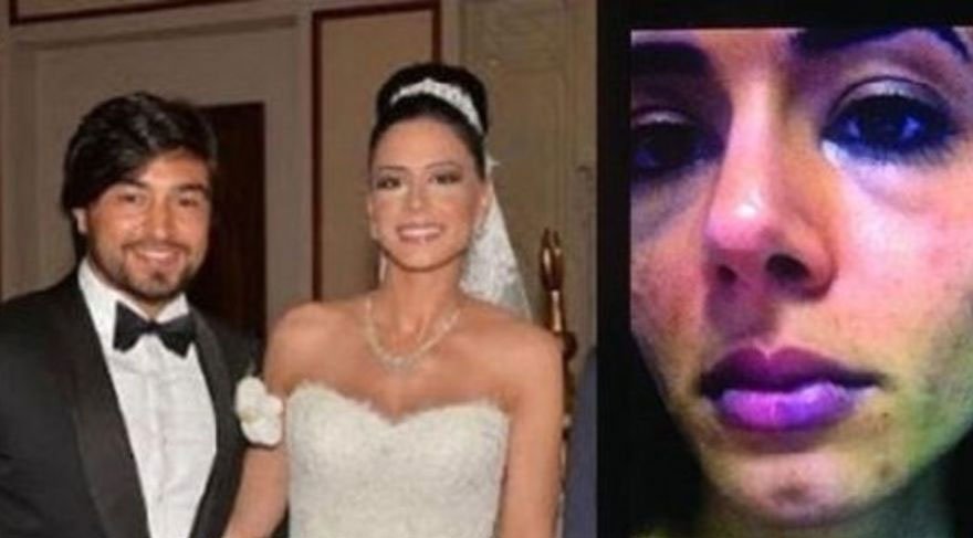 İbrahim Toraman ve Eylem Toraman boşandı!
