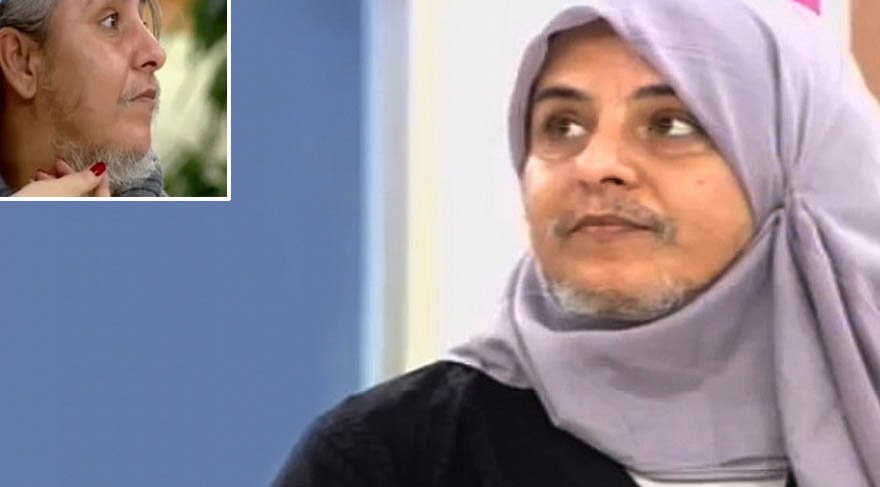 Zahide Yetiş’in programına çıkan sakallı kadın, doğal görünümüne kavuştu
