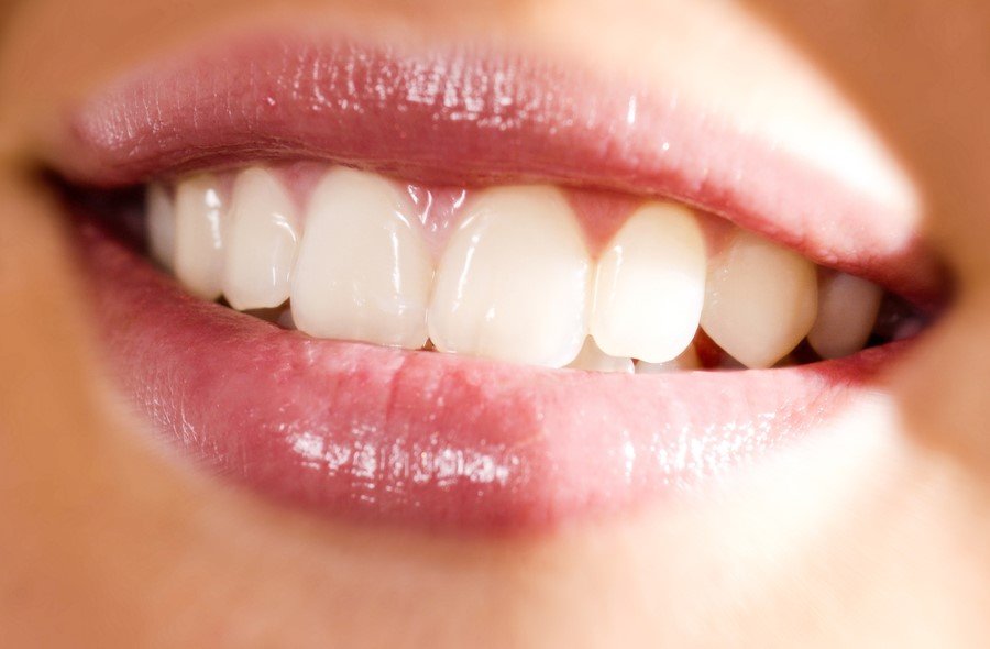 Beyaz dişler neden daha sağlıklı değil? Yaşam Son Dakika Haberler