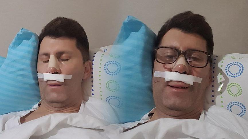 Oyuncu Ahmet Çevik ameliyat oldu