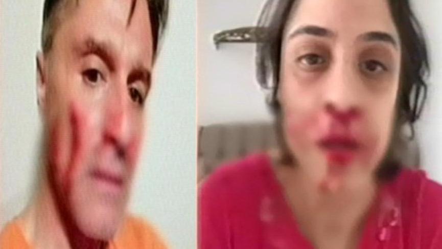 Hazım Körmükçü’nün adının karıştığı ‘Nişanlıya darp’ olayında yeni gelişme!