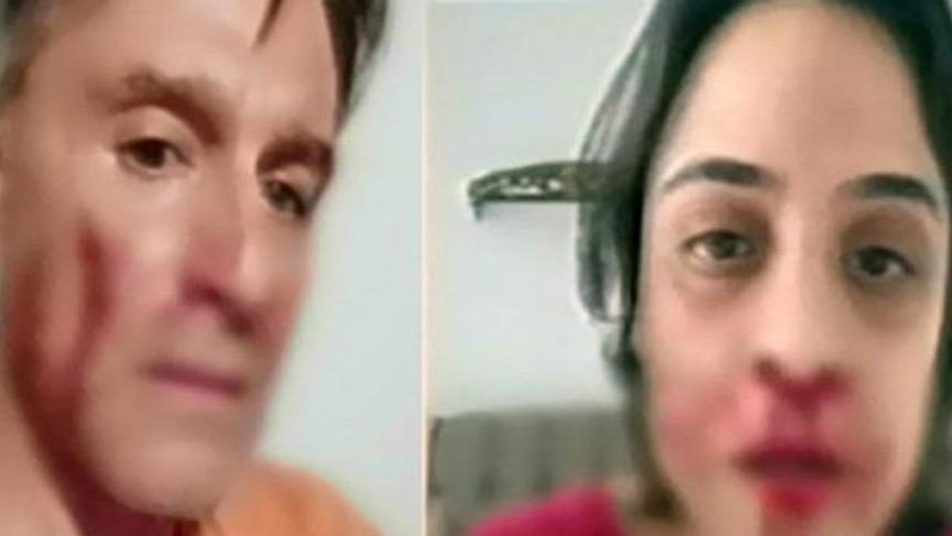 Hazım Körmükçü ve Zeynep Tandoğan canlı yayında yüzleşti! Olay kareler…