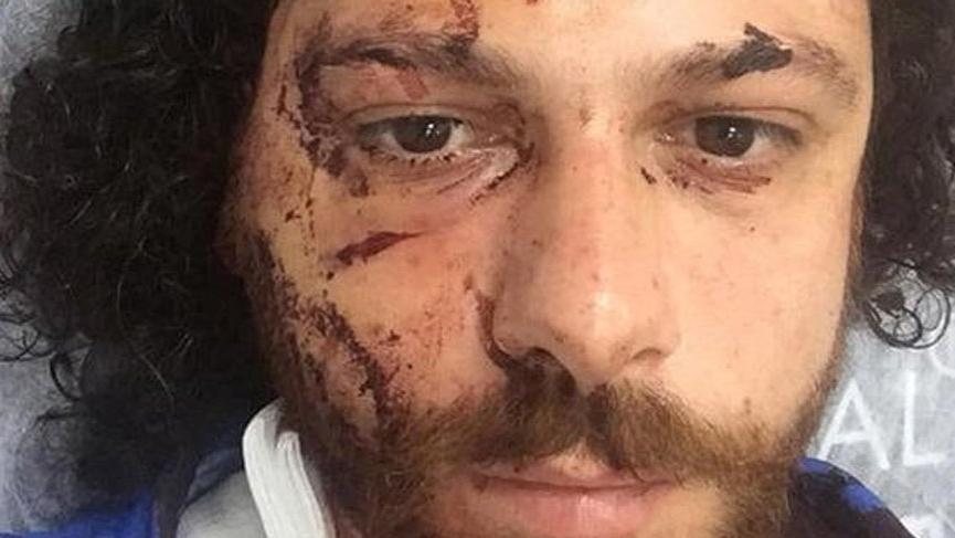 Oyuncu Oral Özer’in yaralandığı bara silahlı saldırı olayının görüntüleri ortaya çıktı