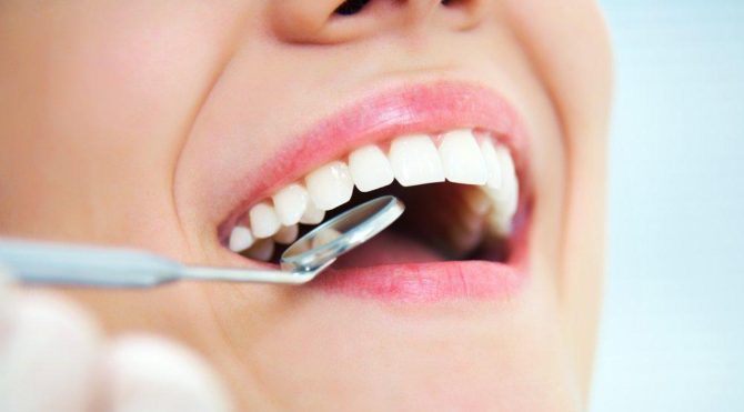 Sağlıklı diş eti ne renk olmalı? Güncel yaşam haberleri