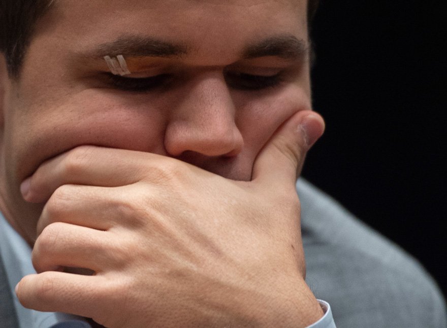 Carlsen, dinlendiği gün bir kaza yaşamış ve gözü morarmıştı.