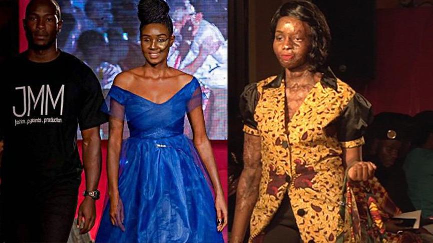 Engelli modeller, Hot Pink Catwalk’ta podyuma çıktı