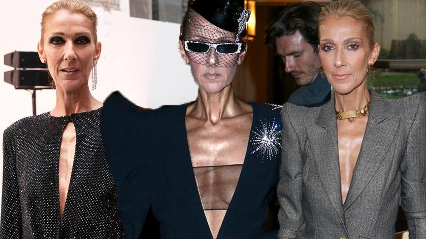 Celine Dion ‘Bulimia’ iddialarına cevap verdi