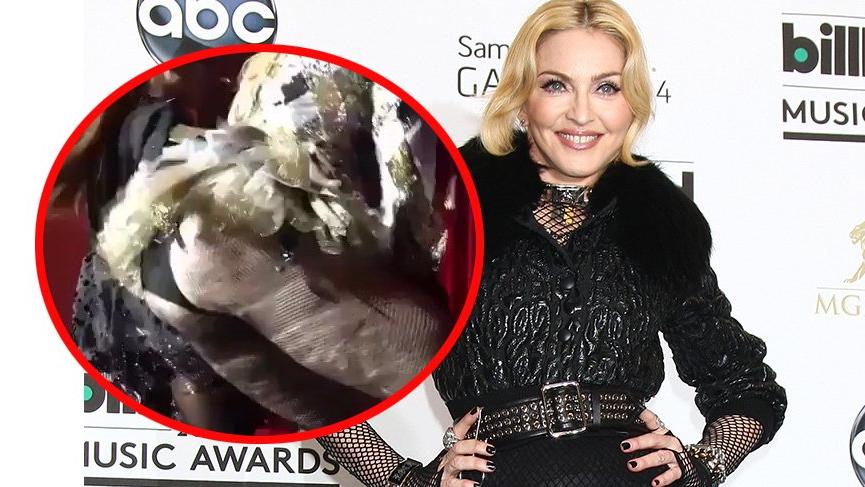 Madonna’nın poposuna implant yaptırdığı iddia ediliyor