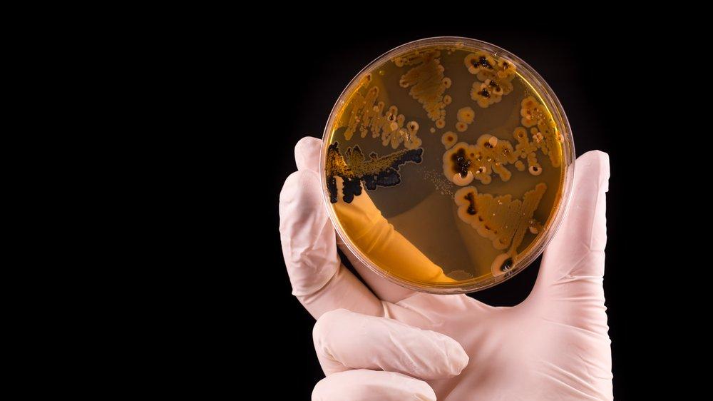 Salmonella Nedir Salmonella Nedenleri Belirtileri Ve Tedavisi Saglik Son Dakika Haberler