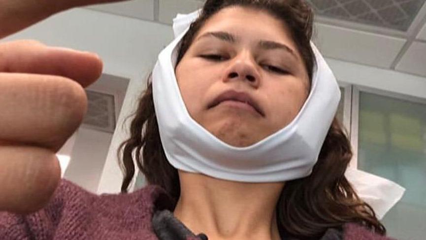 Zendaya’nın ameliyat sonrası paylaşımları şaşırttı