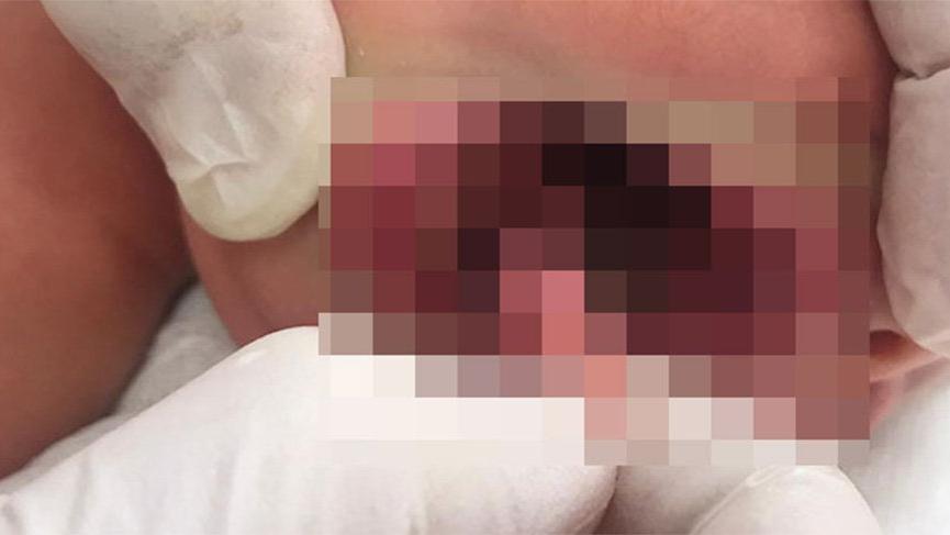 Zeynep bebek doktorları şaşkına çevirdi!