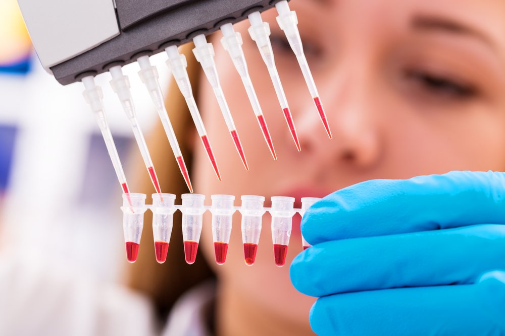 Kök hücre naklinin; tedavilere yanıt vermeyen lösemi, lenfoma, multiple myelom, kemik iliği yetmezliği gibi hastalıklarda önerildiğini belirten İç Hastalıkları ve Hematoloji Uzmanı Doç. Dr. Hasan Atilla Özkan, bu konuda şunları söyledi: