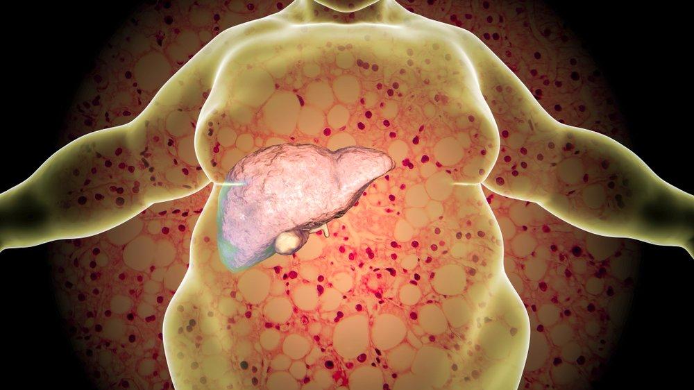 nedenleri ve tedavisi