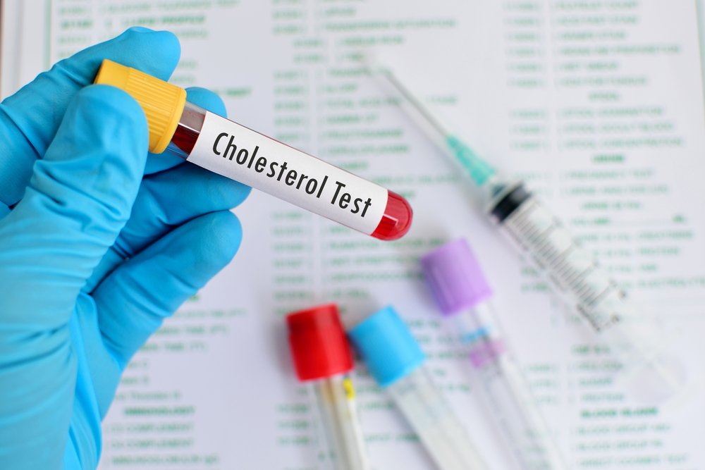 Vücut için sinsi bir tehlike olan yüksek kolesterol günümüzde en yaygın sorunlardan biri. İşte Uzman Doktor Ender Saraç’ın kolesterol seviyesini doğal yollarla aşağıya çeken önerileri...