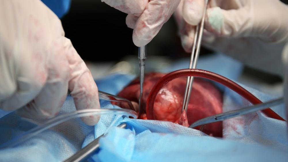 'Beyin ölümünde organ bağışı oranı artmalı'
