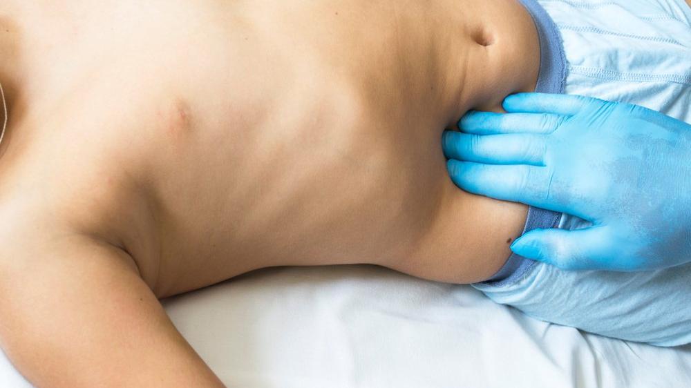 Apandisit Teshisi Icin Hangi Bolume Doktora Gidilir Saglik Son Dakika Haberler