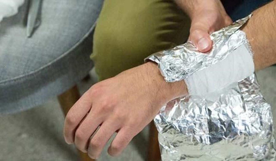 Amerikalı araştırmacılar, doktorların taze yanıkları folyo ile tedavi etmelerini öneriyor. İlk önce, yarayı dikkatle temizleyerek, yanık üzerinde oluşan suyu temiz bir havluyla temizleyin. Merhem sürün ve üzerine gazlı bez sarın. Gazlı bezin üzerine de folyoyu sarın. Bantla sabitledikten sonra acı hafifleyene dek bekleyin.