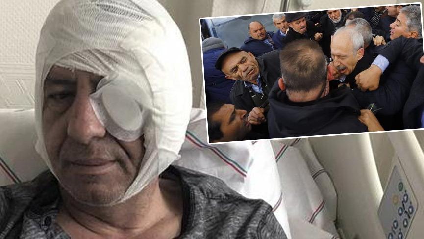 Yavuz Selim Demirağ’a saldıranlar serbest bırakıldı